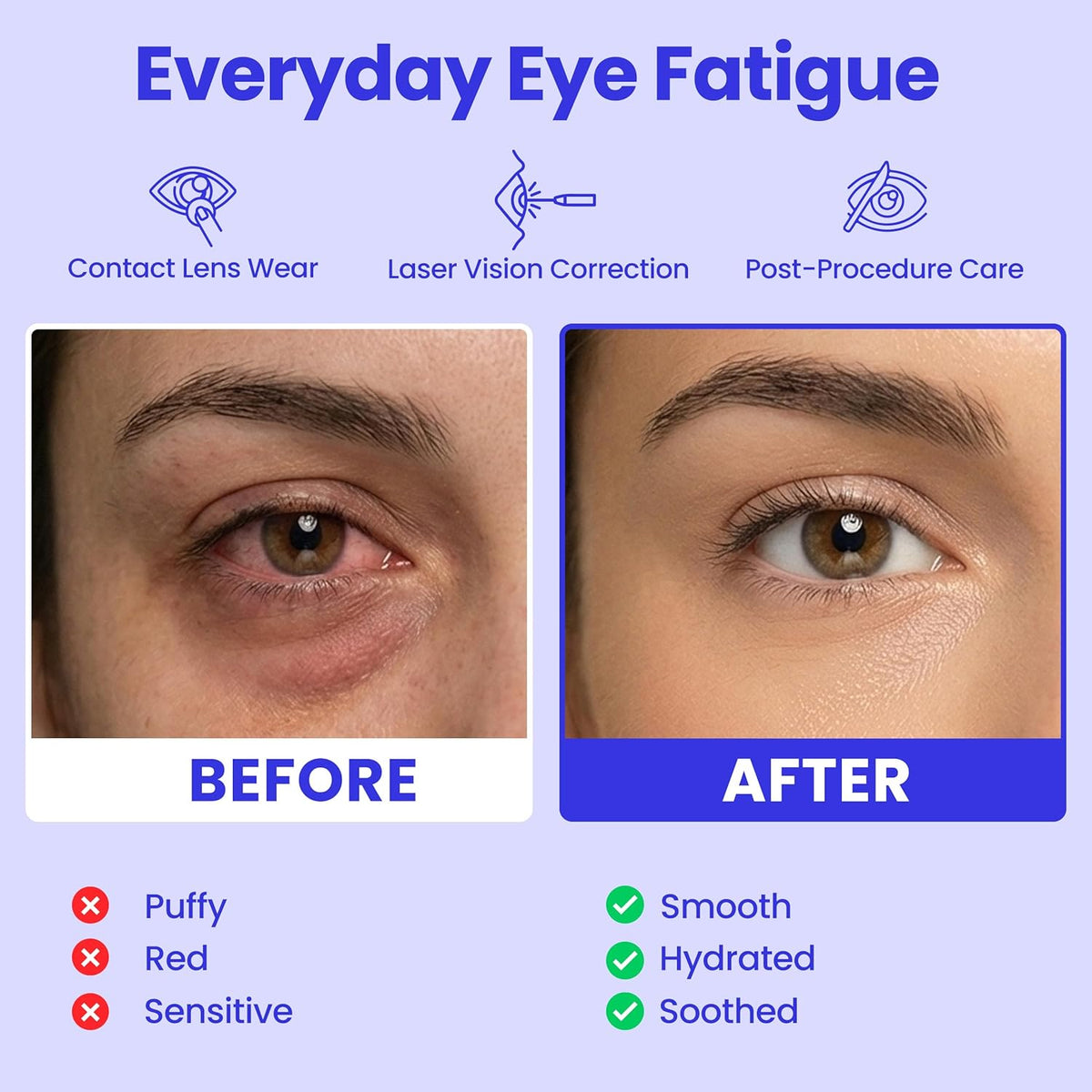 DreamSleep Steam Eye Mask
